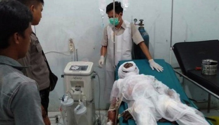 Korban luka bakar - Toyota Agya terbakar di SPBU - lubuk Besar Bangka